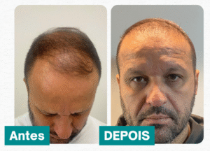 Anderson Rogerio Remonte