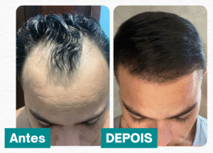 Antes e Depois - Cabeloz [Storie] (14)