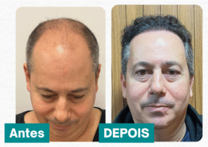 Antes e Depois - Cabeloz [Storie] (26)
