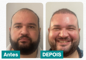 Antes e Depois - Cabeloz [Storie] (27)