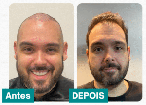 Bruno Verrone