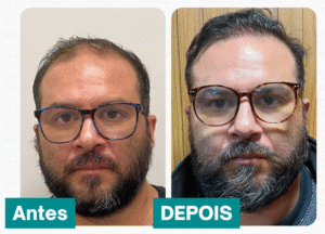 Rafael Corassa dos Santos