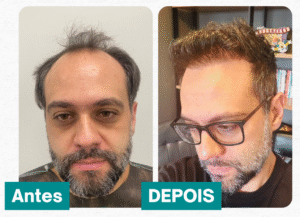 Thiago Melguinha Fonseca